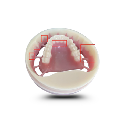 Double layer PMMA