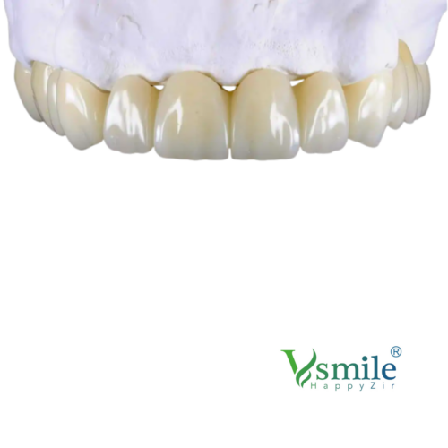 PMMA Vsmile