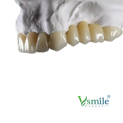 Vsmile PMMA