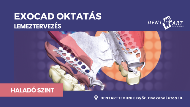 EXOCAD Haladó